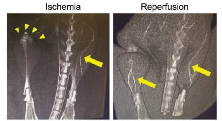氫氣吸入和氫鹽水注射效果哪個強 氫氣醫學研究的重點在疾病治療效果確定性