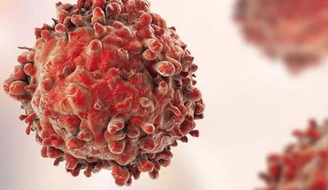 氫分子對腫瘤生長有一定的抑制作用,在放療和化療中提高療效,減少副作用.jpg 氫分子對腫瘤生長有一定的抑制作用,在放療和化療中提高療效,減少副作用.jpg